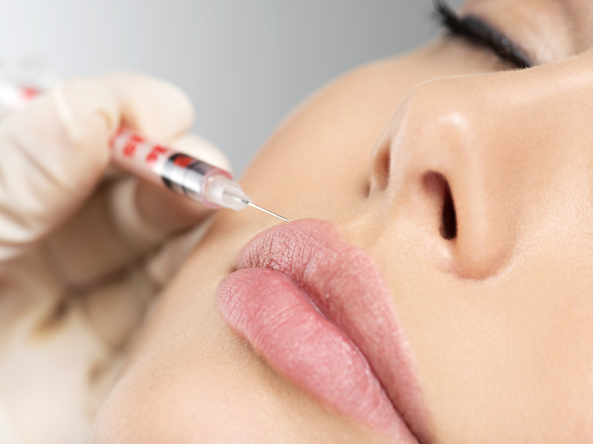 young woman gets botox injection in her lips