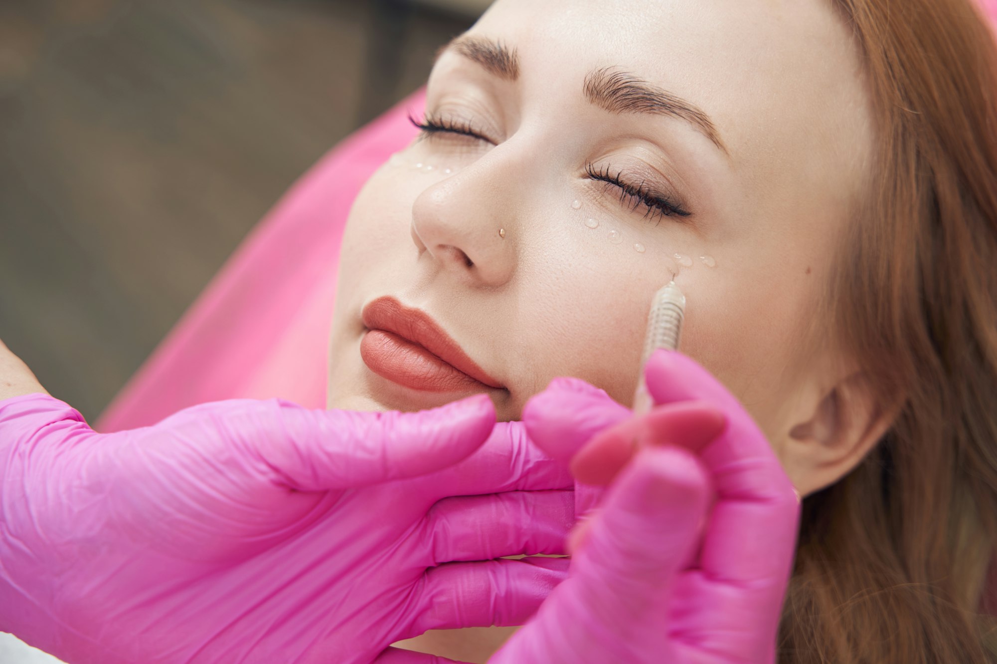 Female is getting injections with hyaluronic acid for smoothing of face wrinkles