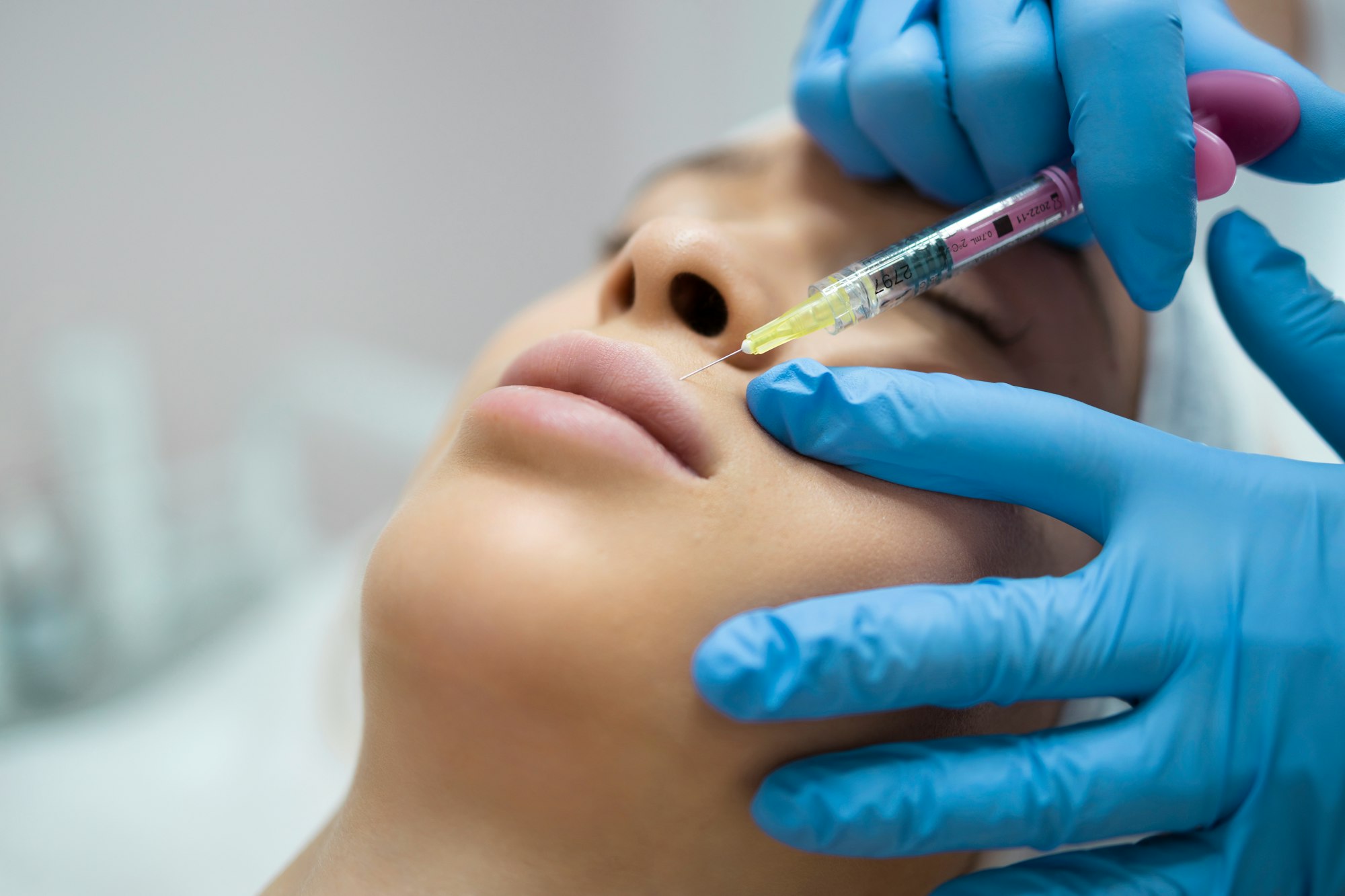 Lip augmentation and correction procedure close-up. Hyaluronic acid injection