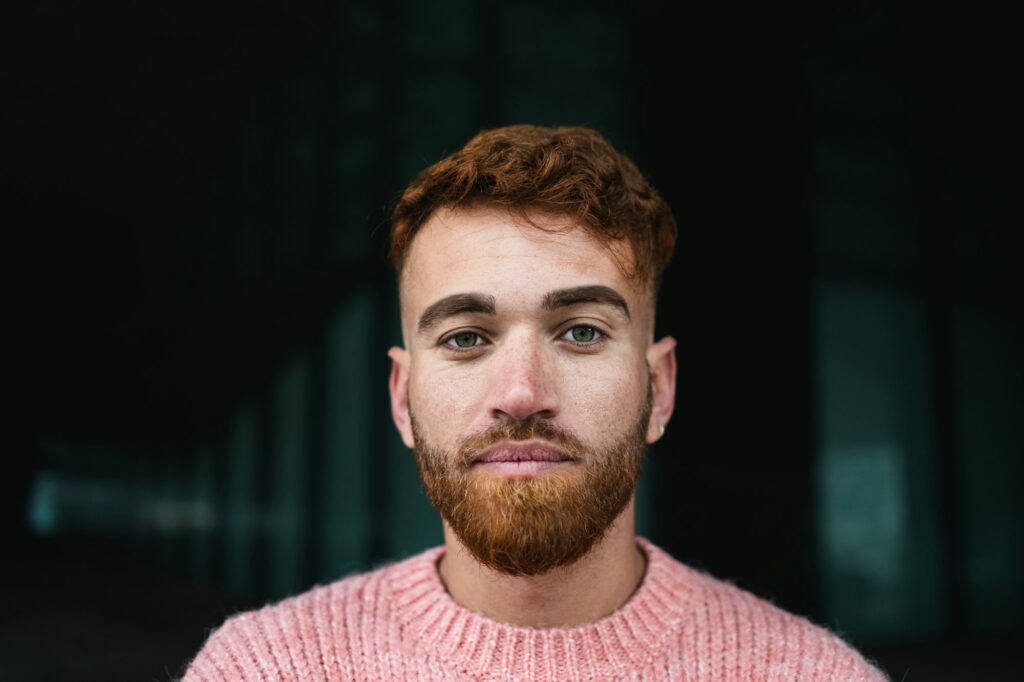 Portrait of young man with red hair looking at the camera after hair transplantation in the cyity of avignon