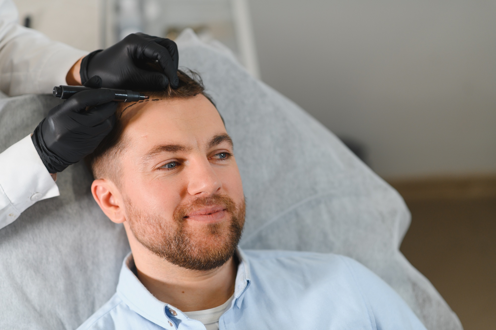 Doctor marking young man's forehead with hair loss problem
