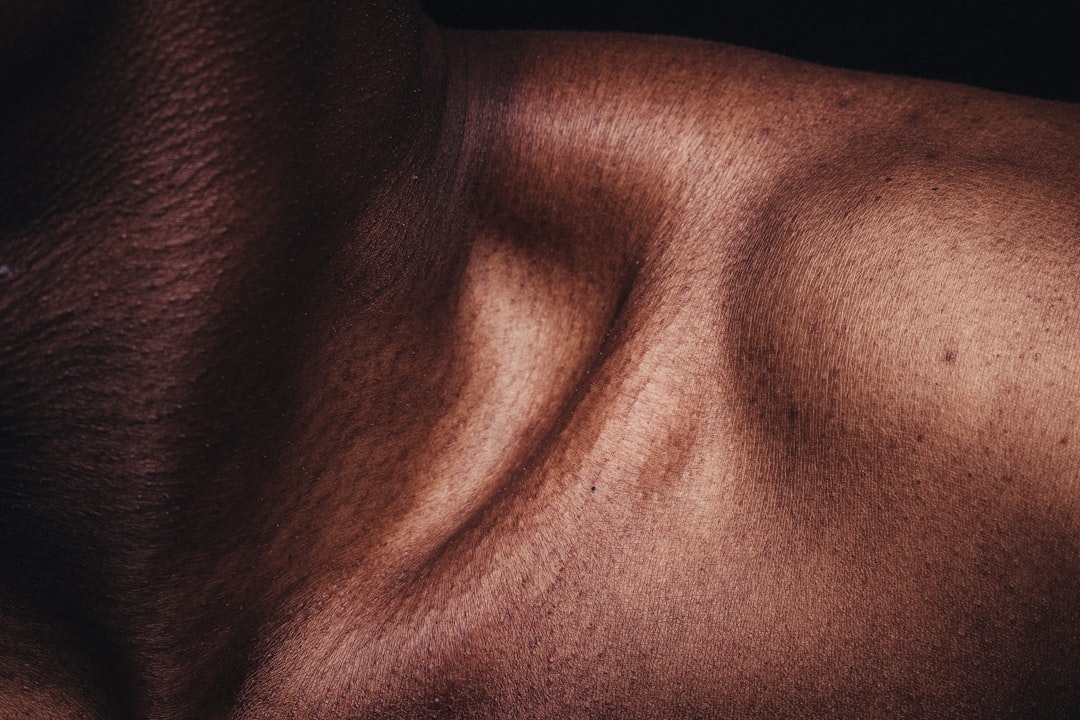 Photo Skin tightening