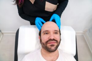 Professional Examination of Scalp Before PRP Hair Treatment