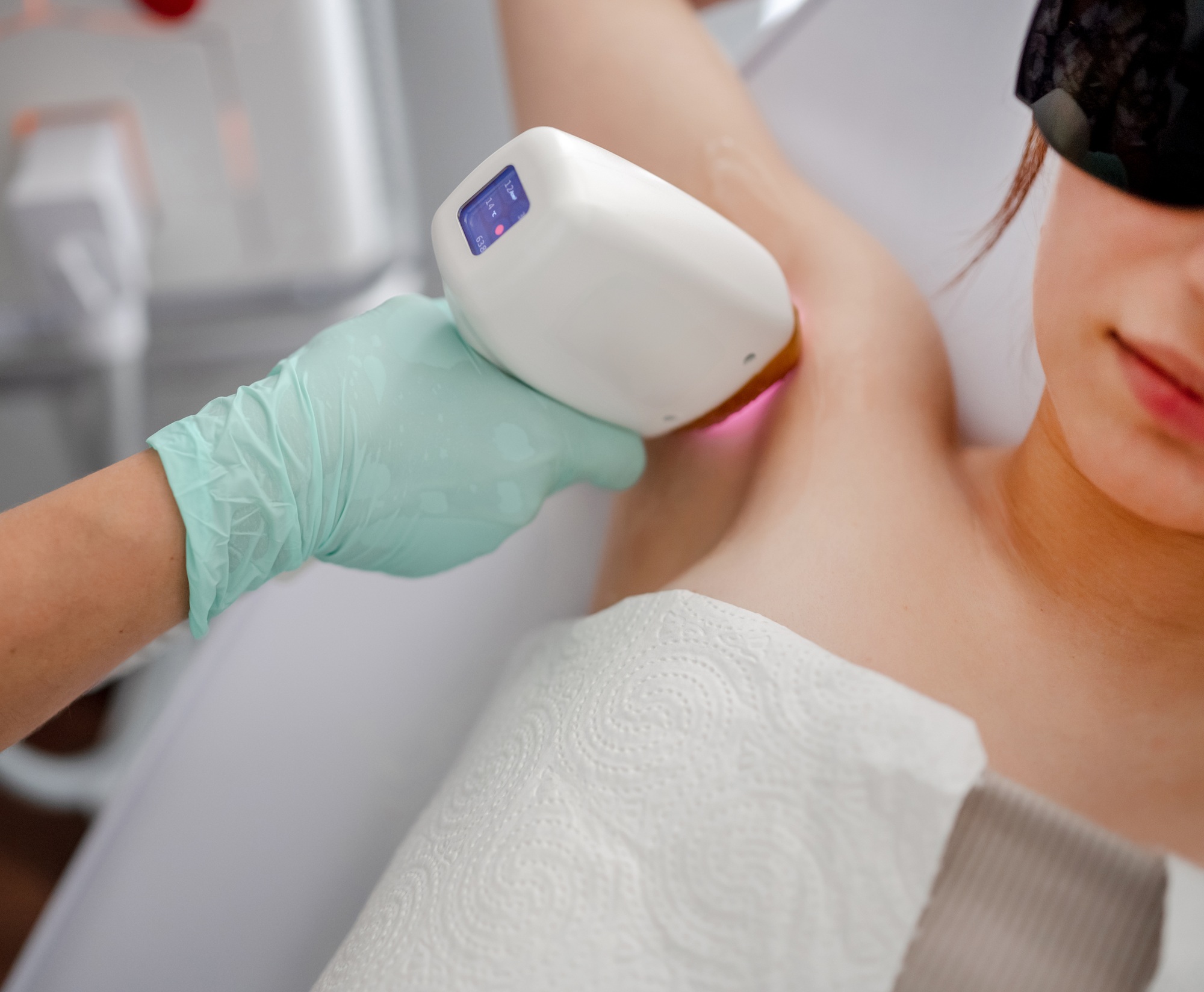 Master Conducts Laser Hair Removal Procedure