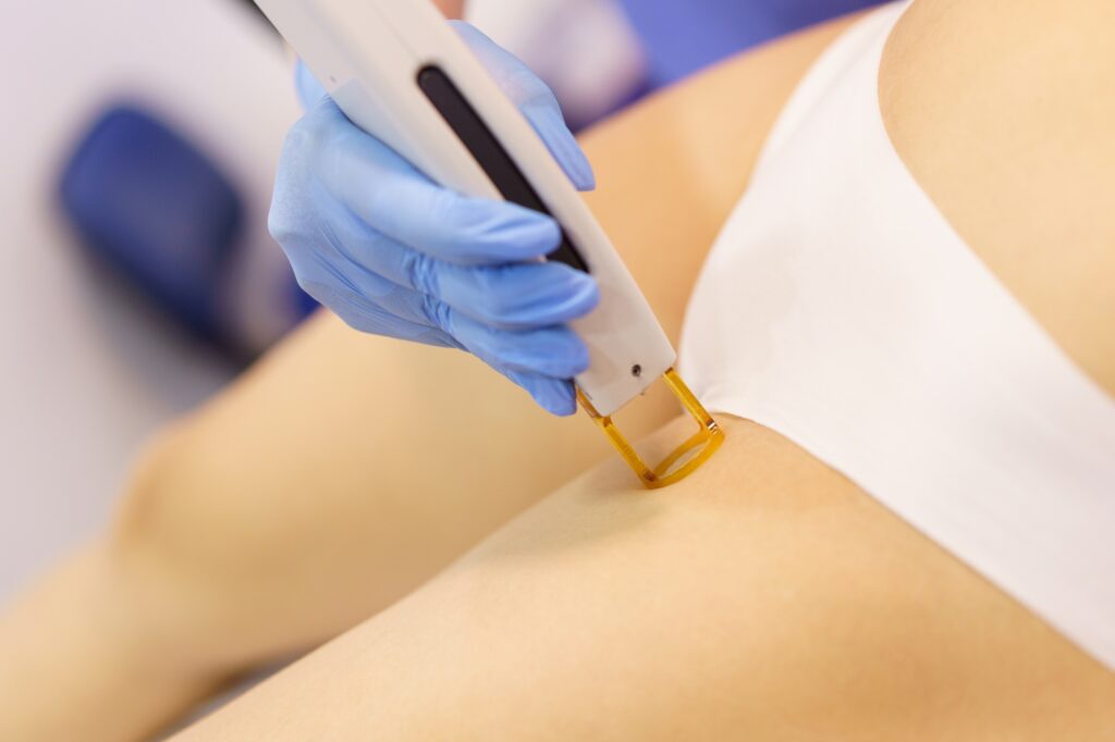 Woman receiving groins laser hair removal at a beauty center.