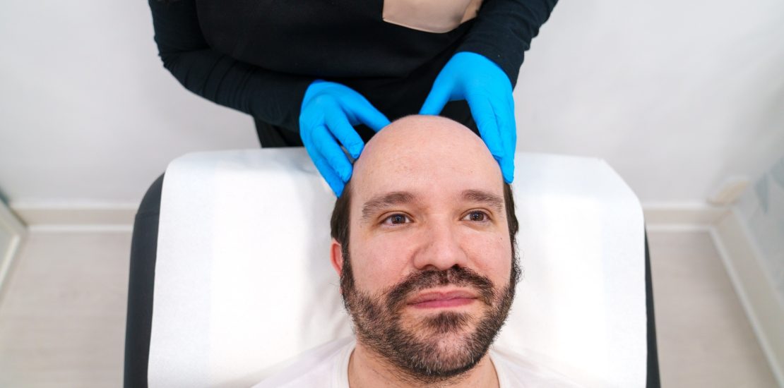Professional Examination of Scalp Before PRP Hair Treatment